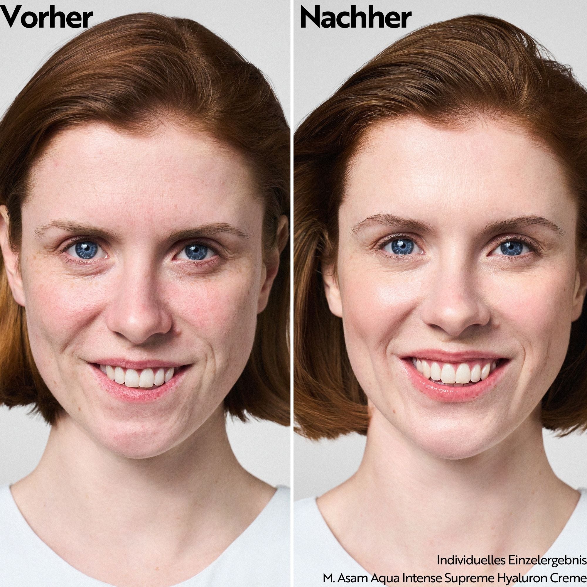 M. Asam Aqua Intense Supreme Hyaloúron Cream 50ml