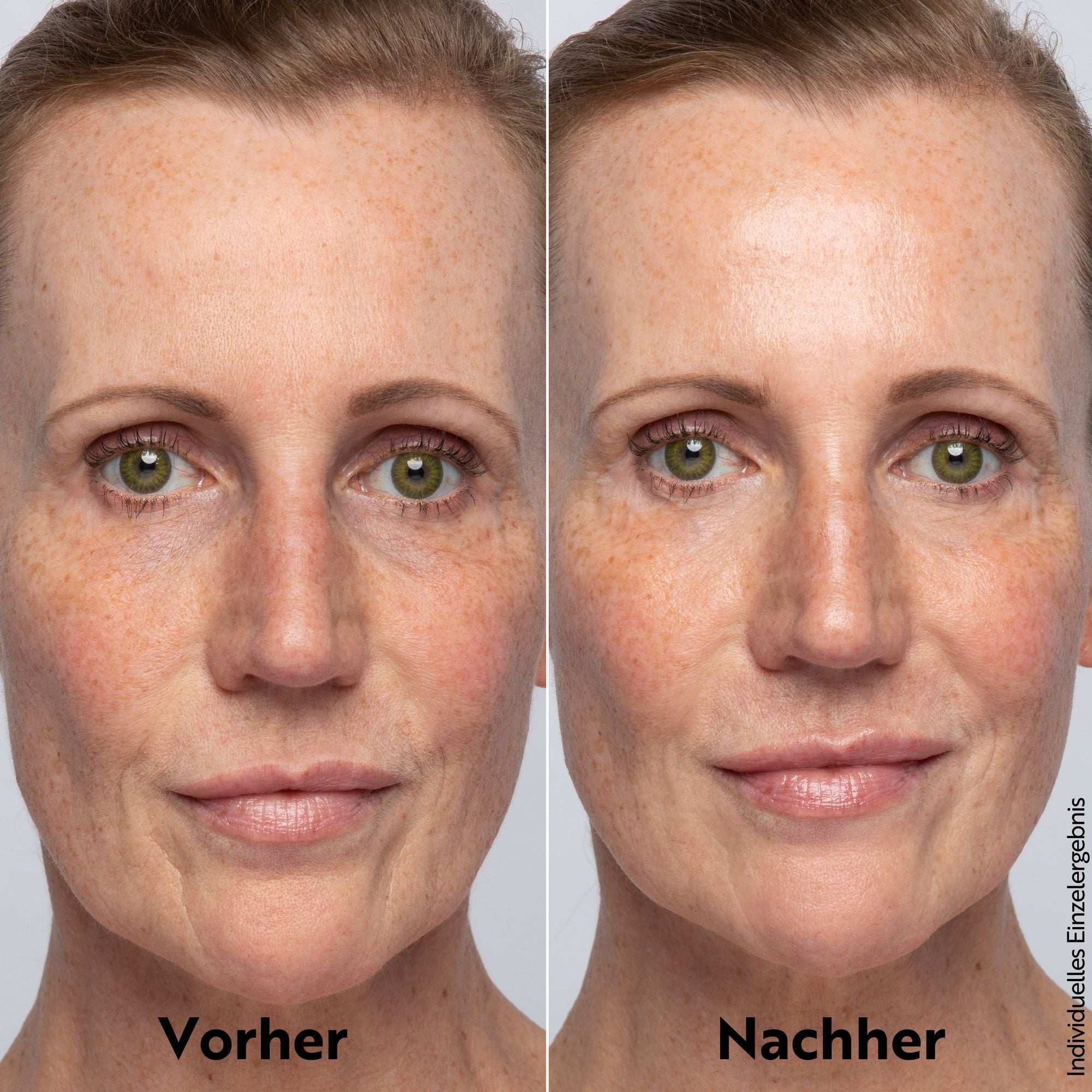 M. Asam Vitamin C Glow Feuchtigskeitscreme